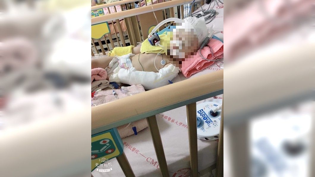 1歲女童疑遭虐致重傷 家屬悲慟將拔管器捐