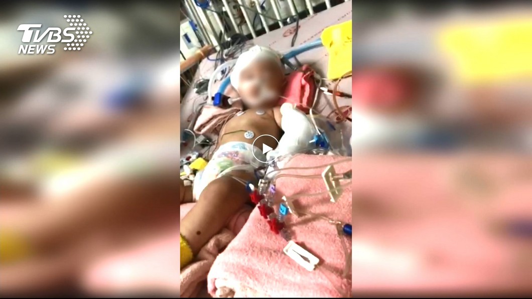 女童遭虐傳今午拔管 母淚崩:最好情況癱瘓最壞腦死