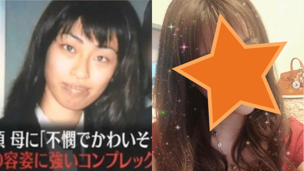 母親的話讓她心碎 18歲起狂整300次成「整形怪物」