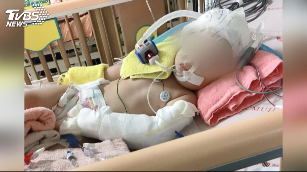 台中重摔女童致偏癱案 保母被依重傷害罪起訴