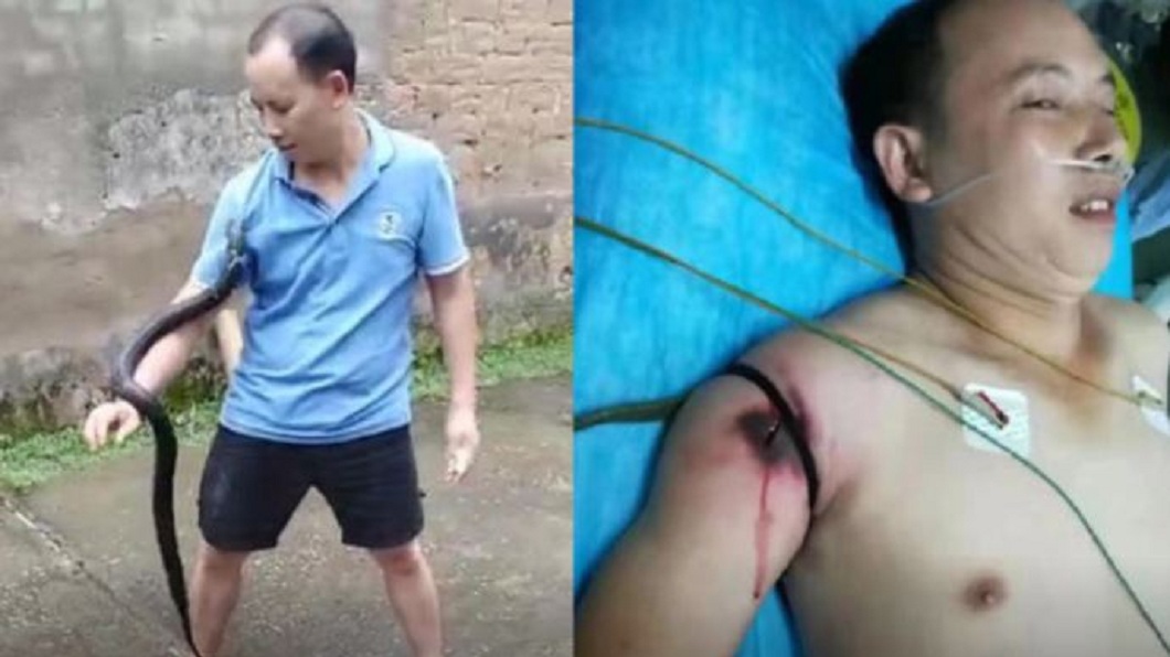 搏點擊率玩命 男把玩眼鏡蛇被咬毒發身亡
