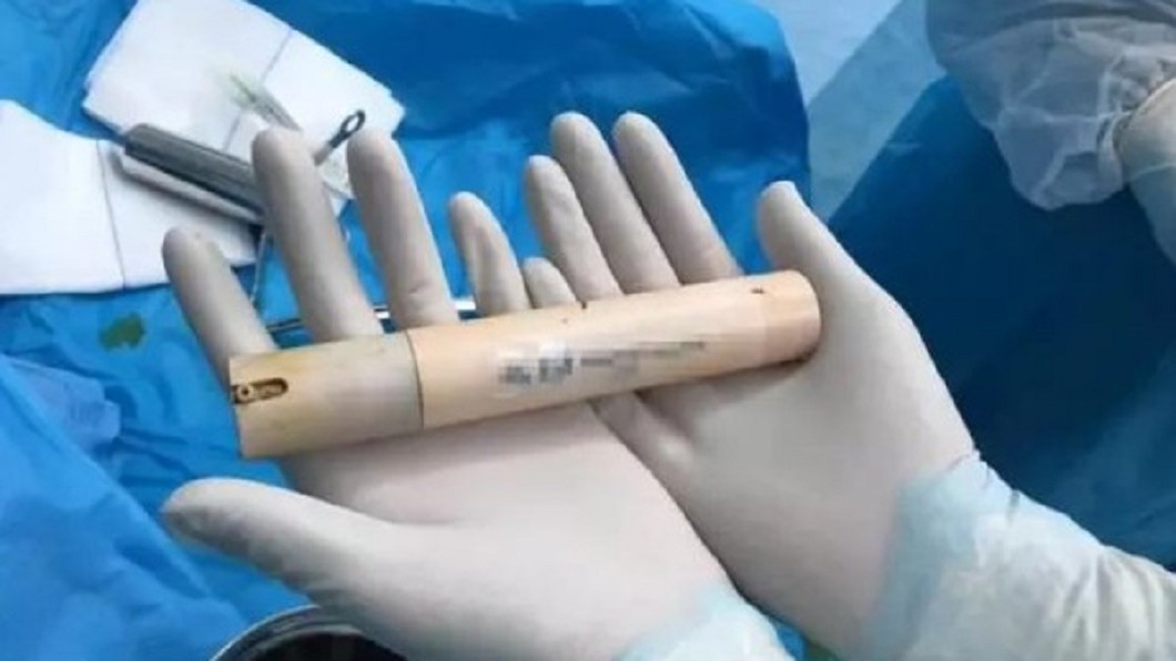 男洗澡不慎跌倒 這根面霜棒滑進直腸忍2天才就醫