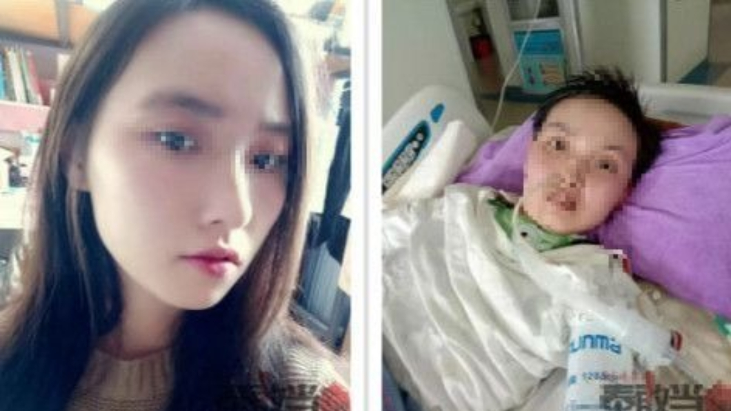 只是被蚊咬!正妹竟罹患腦炎 呼吸衰竭「慘住院1年」