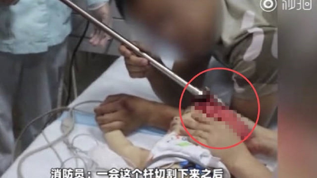 爸媽吵架怒丟曬衣桿…直插腦袋「男嬰狂噴血」險亡