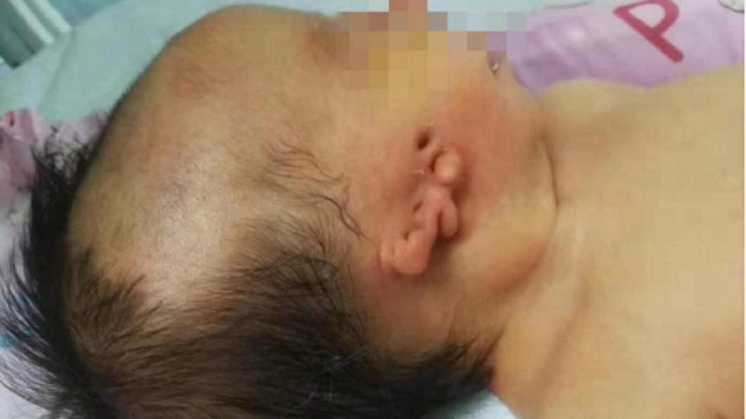 喜迎寶貝!新手爸接手一看 女兒「全臉畸形」嚇壞拒養