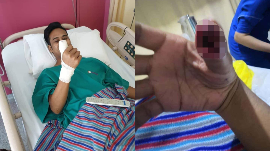 保護貼碎掉繼續用!他大拇指「劇痛爆膿」…下場超慘