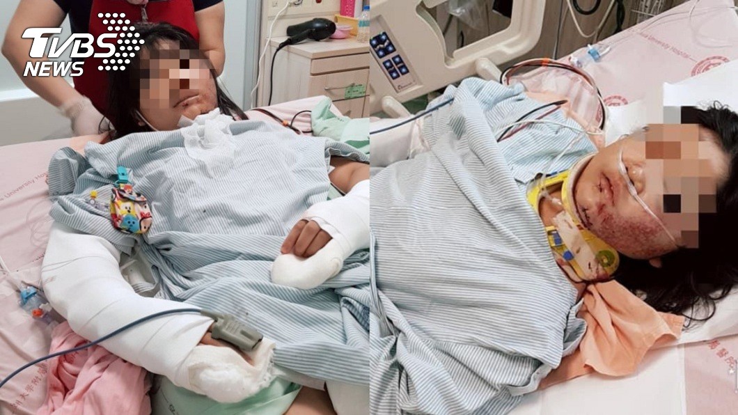 暑輔遭推下樓！女骨折脾臟撕裂　母淚：兇手回教室吃早餐