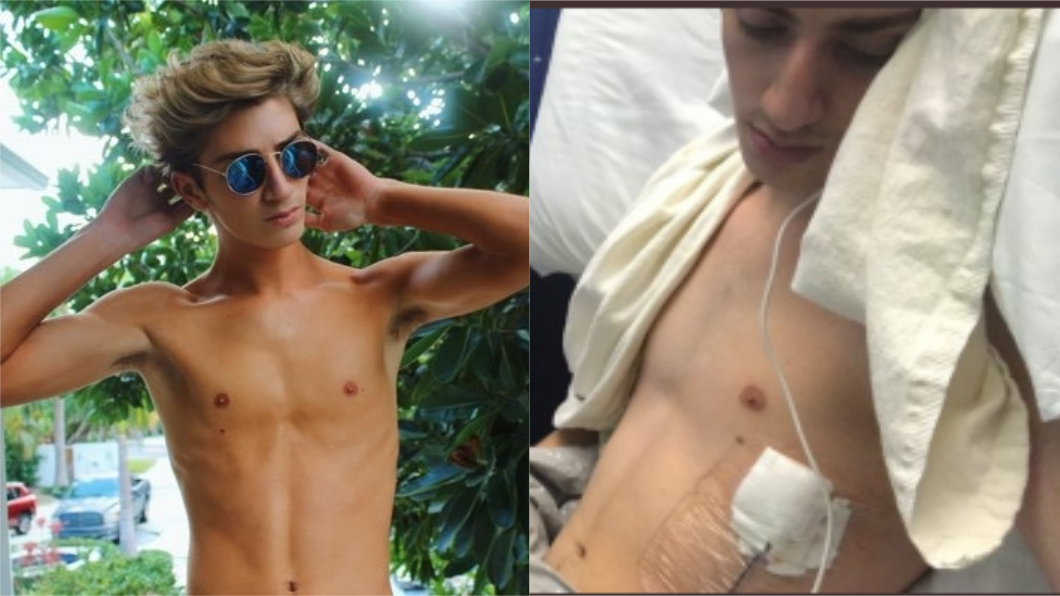危害比香菸小？18歲男大生抽電子菸　肺塌陷險喪命！
