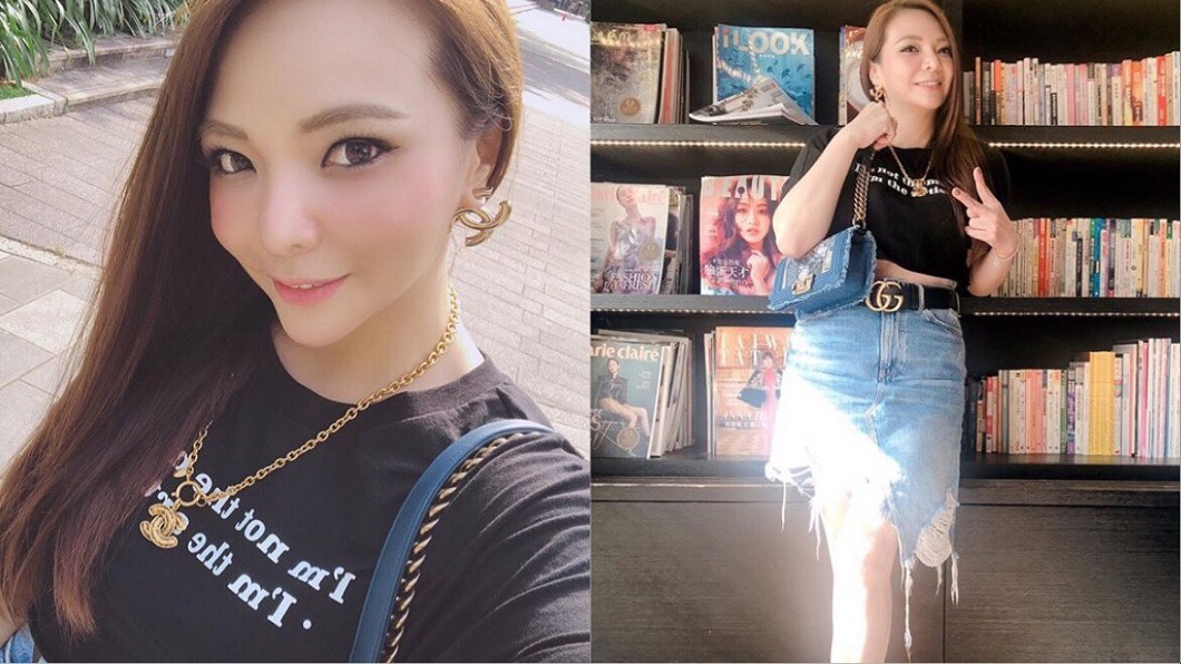 小甜甜「又瘦了」曬性感美照!網驚見:腿插了一隻鐵桿…