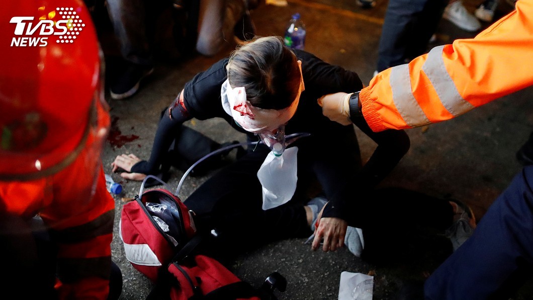 港警射爆女子眼睛 反送中號召百萬人塞爆機場