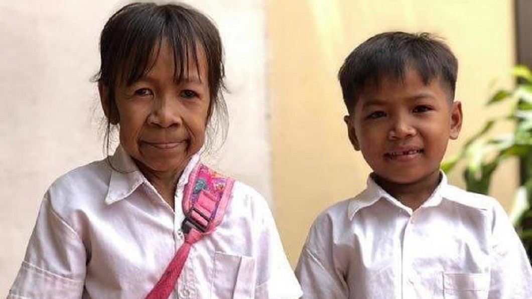 10歲女滿臉皺紋像老人!僧:「這個」太重