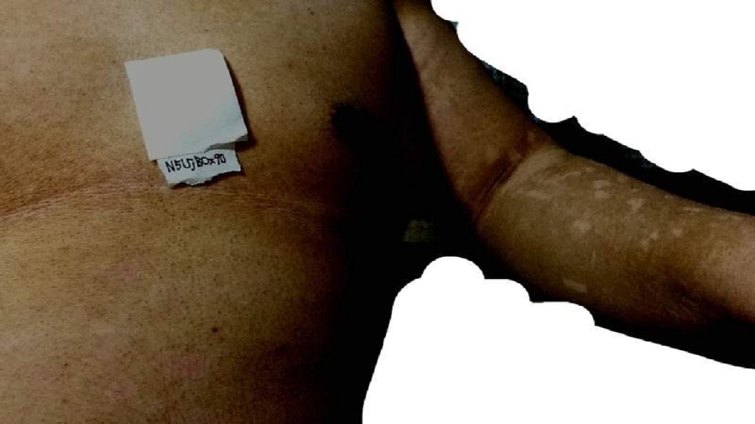 日本一名38歲男子自稱7年沒洗澡，全身都是陳年黑垢。(圖／翻攝自2ch論壇)