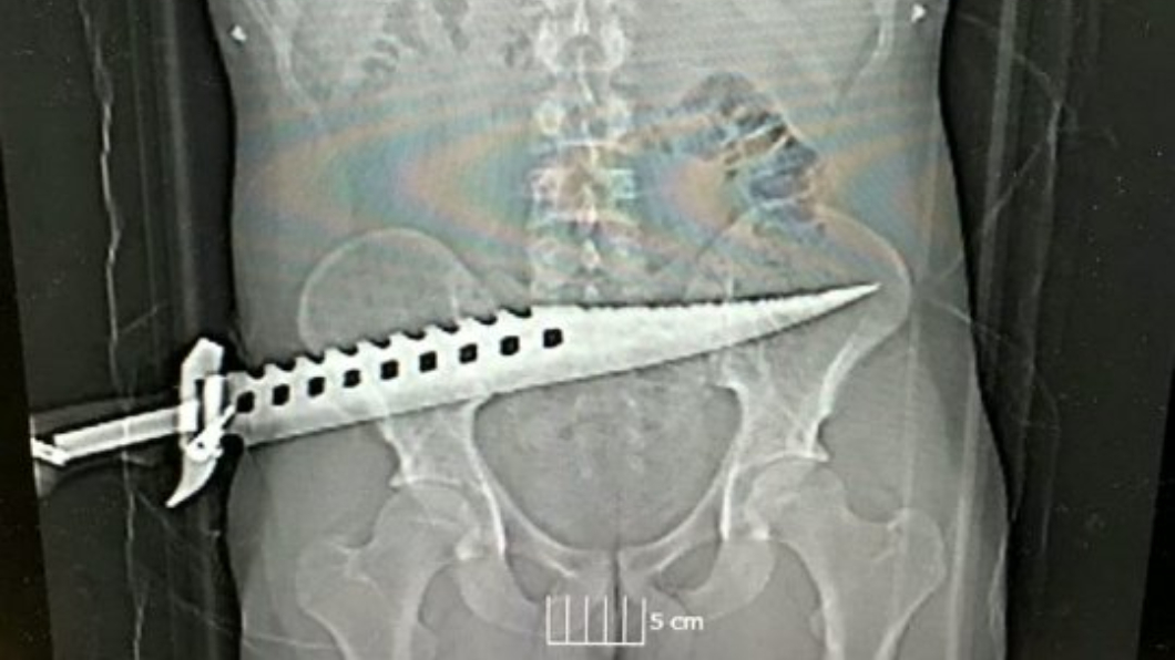 圖／翻攝自SWNS