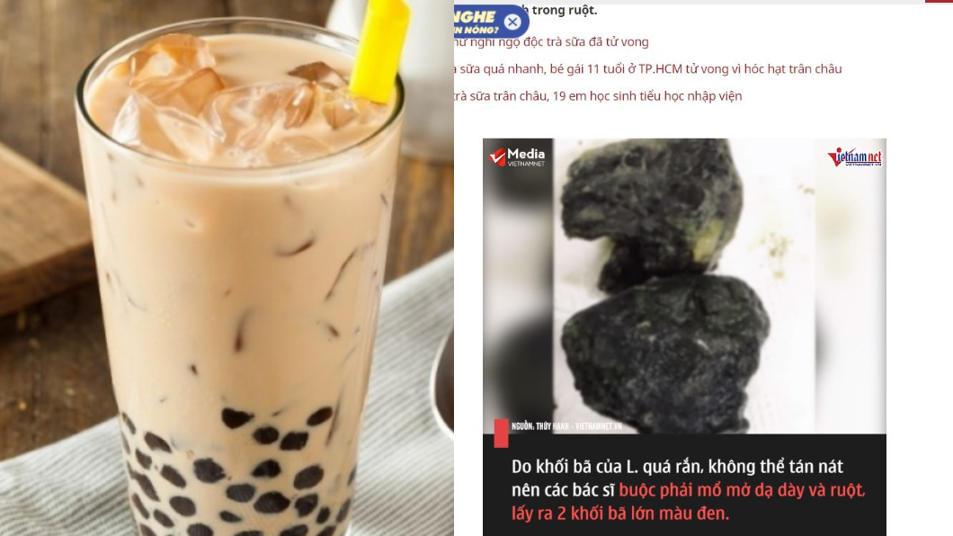 天天喝珍奶!男肚痛嘔吐 腸道竟藏2大塊「黑礦石」