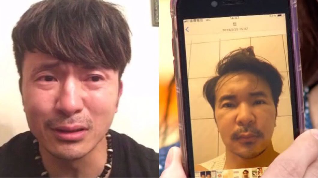 唐從聖驚罹怪病臉變形!視訊女兒崩潰:怕看不到她長大
