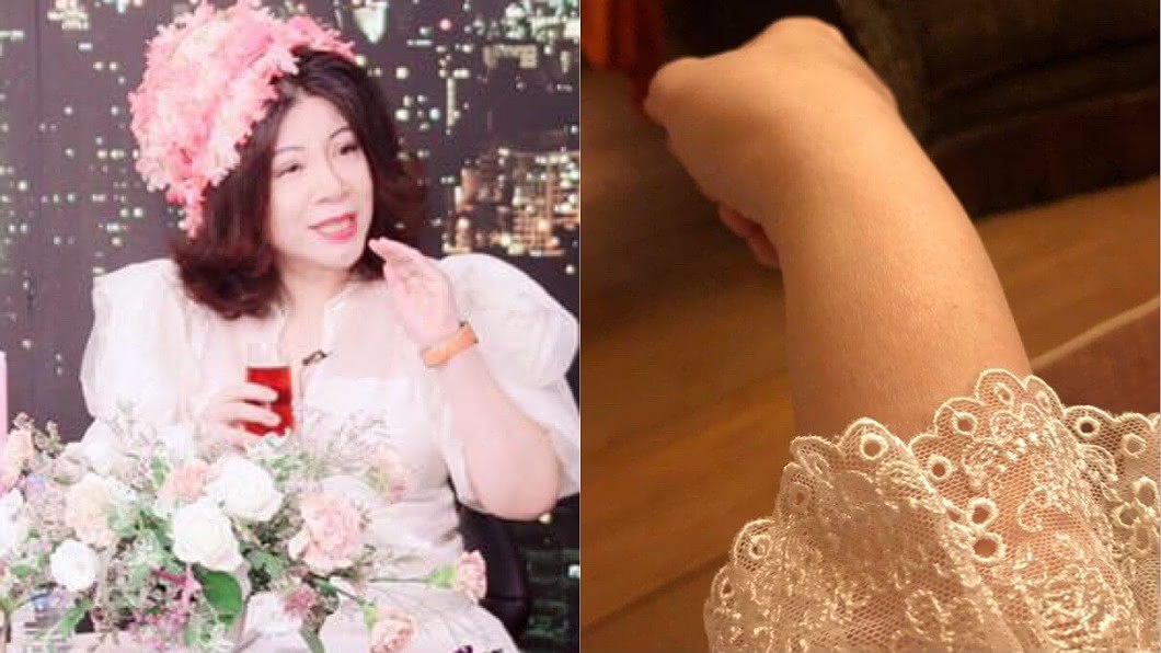 肺腺癌才剛好...陳文茜驚爆左臉+右手如癱瘓中風