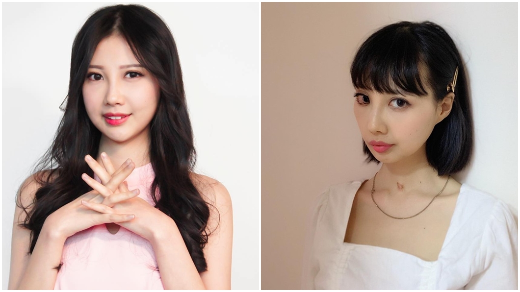 罹癌7年面癱「闔不上眼」 30歲女星鼓起勇氣做這決定