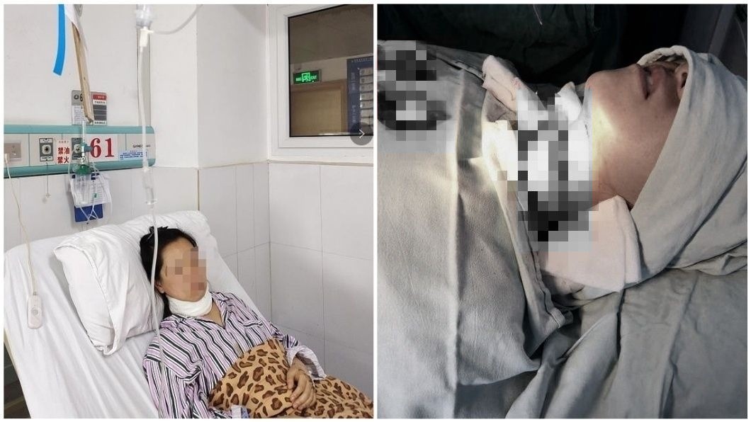 婦接孩子遭前夫割喉 6歲女目睹嚇喊:報警抓我爸爸