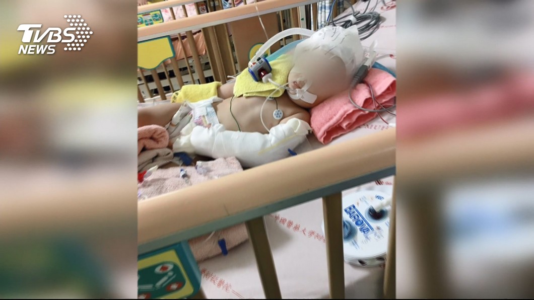 虐1歲女童陷昏迷 保母遭提重傷害起訴