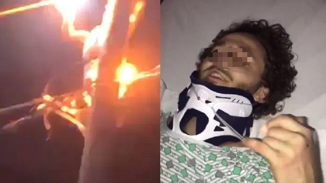 醉男爬9米電線桿「觸電火噬」 命大求募款沒人理