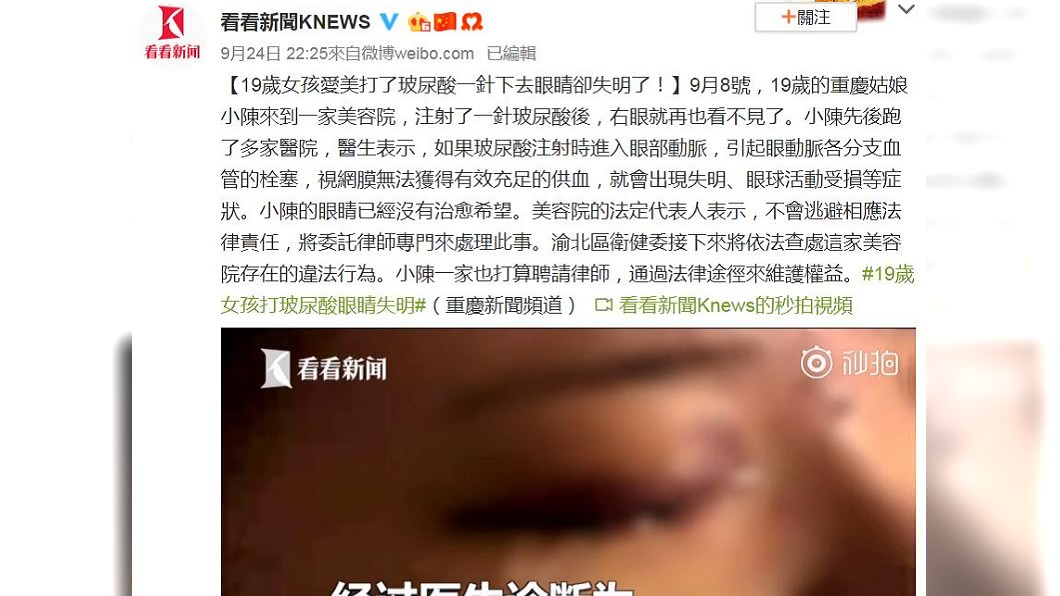一名重慶少女日前注射玻尿酸,不幸造成右眼失明。圖/翻攝自看看新聞KNEWS微博