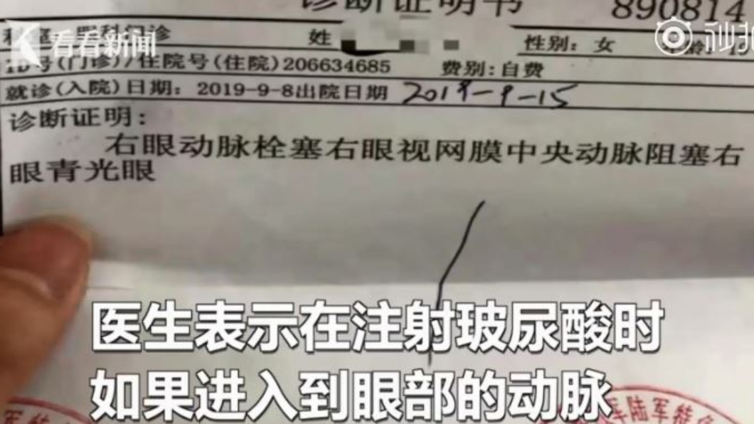玻尿酸進入眼動脈各分支血管栓塞,導致視網膜無法充足供血。圖/翻攝自看看新聞KNEWS微博