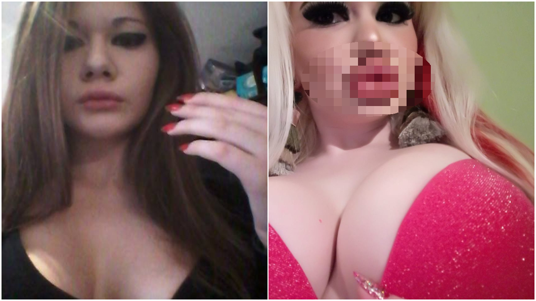 梁朝偉輸了！　22歲女狂整15次「世界級香腸嘴」