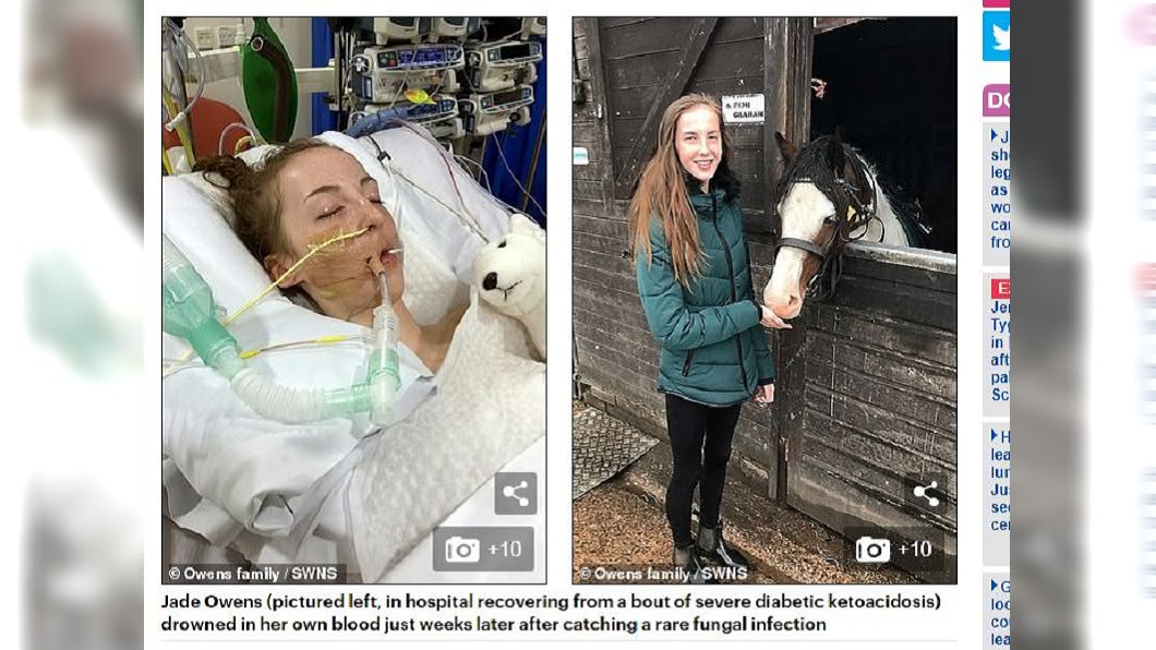 英國1名14歲少女日前和家人去騎馬後,竟然導致吸入黴菌孢子,結果引發真菌感染。(圖/翻攝自每日郵報)