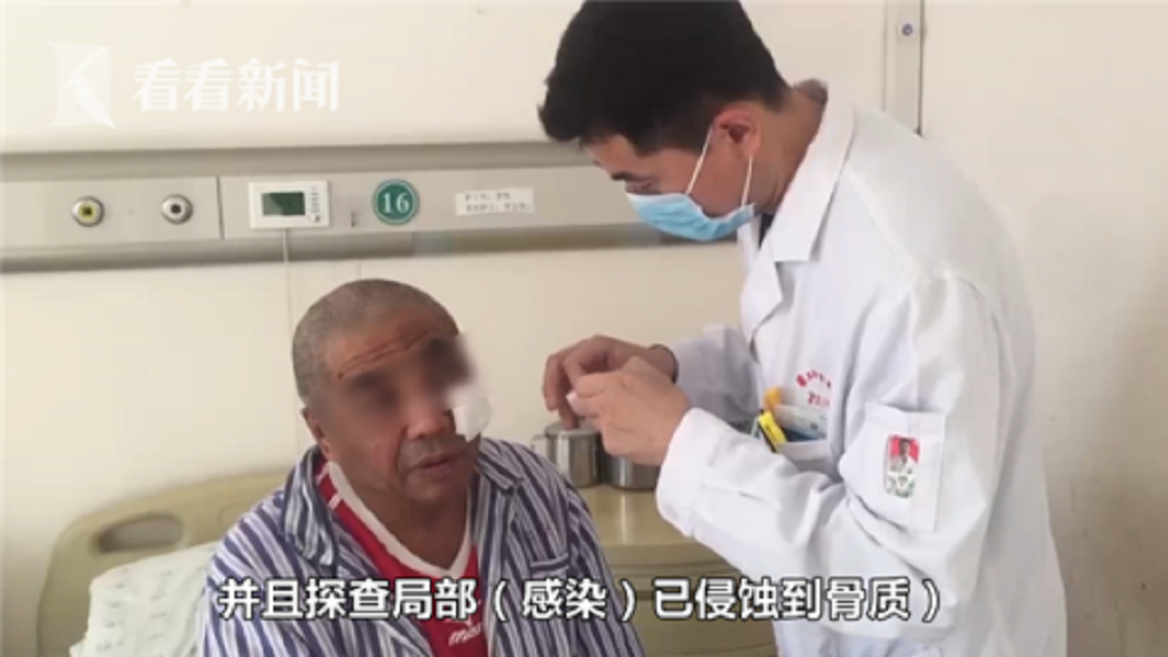 醫師診斷,男子的感染嚴重,細菌已經侵蝕到骨頭。(圖/翻攝自看看新聞)