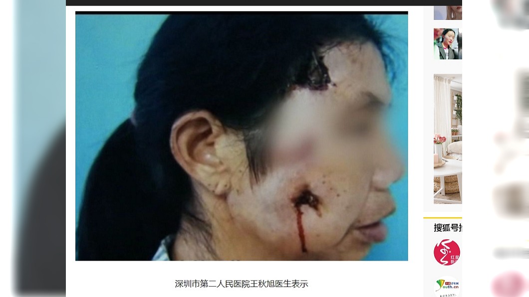 狂流膿汁臉快爛!女肉裡藏8cm樹枝 家人揭驚人真相