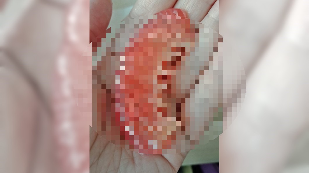 她秀「吃胚胎照」閨密嚇瘋　真相曝光網笑：有陰影了