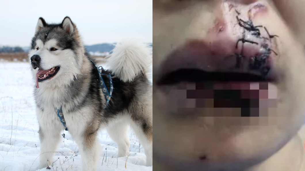 嚇!她興奮餵好友愛犬…下秒「嘴唇被吃掉」爆血破相