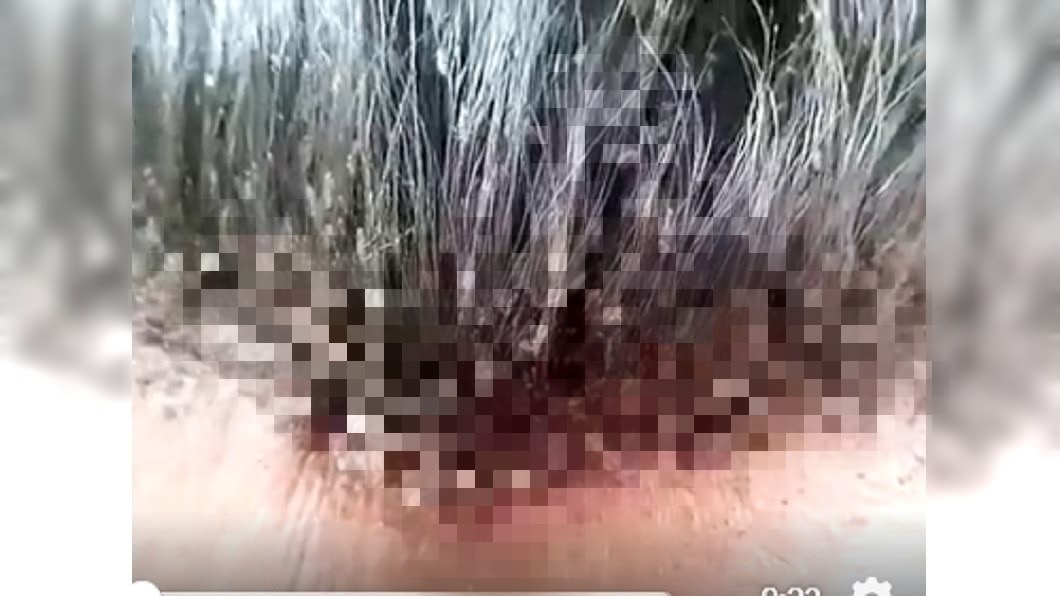 一掀瀏海…百隻頭蝨蠕動狂爬 網崩潰:全身都在癢