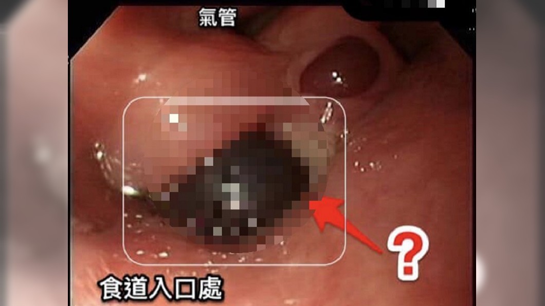 圖/錢政弘醫師提供