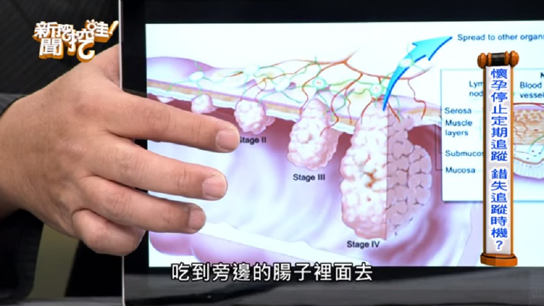 圖/翻攝自YouTube《新聞挖挖哇!》頻道