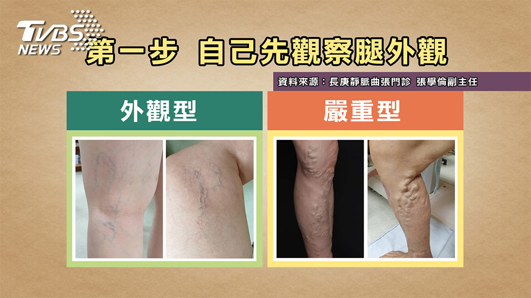 圖/TVBS提供