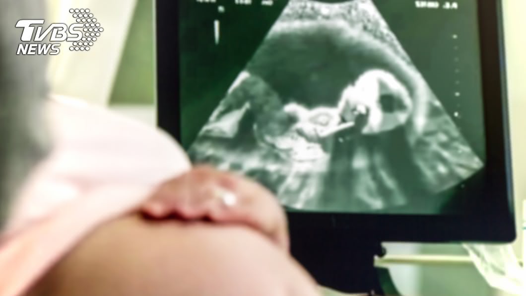 孕婦照超音波見詭畫面嚇歪 醫驚:非常罕見