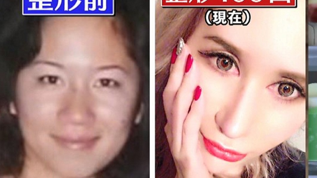 砸3千萬整形百次!平凡女如願變身「真人芭比」