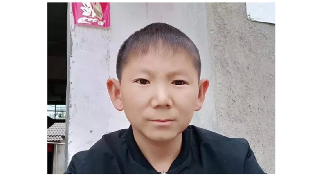 6歲遭石塊爆頭!男終身童顏 嘆無法成家