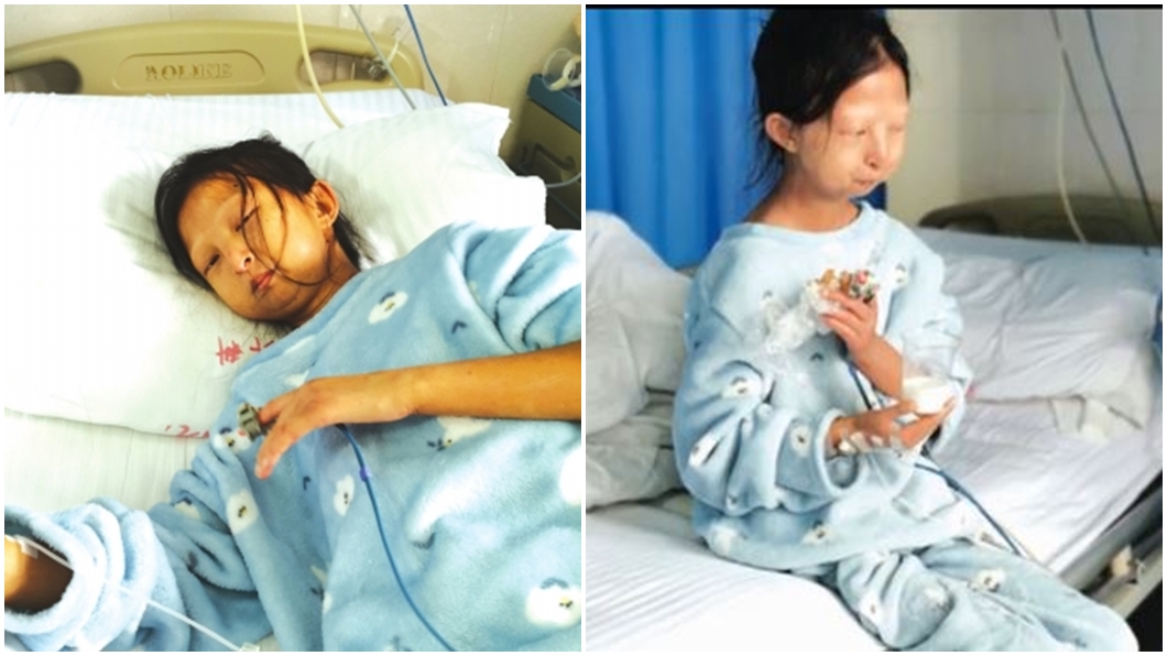 為救病弟日花10元吃飯 她瘦到剩21公斤心臟出問題