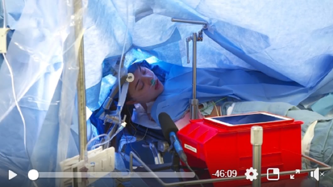 女大生直播開腦手術!全程清醒上萬人觀看