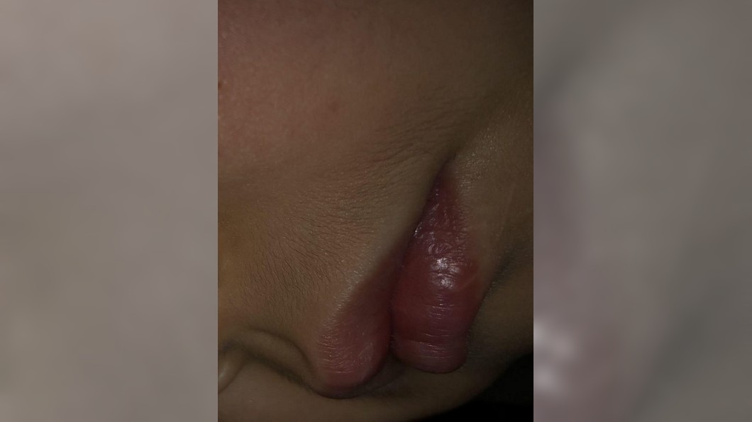 女童還長出鬍子。圖/翻攝自紅星新聞