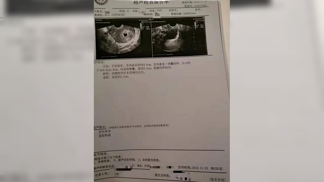 蔣女知道懷孕後立刻進行流產手術。圖/翻攝自澎湃新聞
