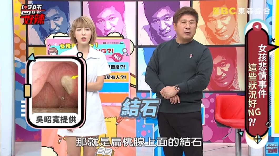 少女的結石超大塊。圖/翻攝自YouTube《醫師好辣》頻道
