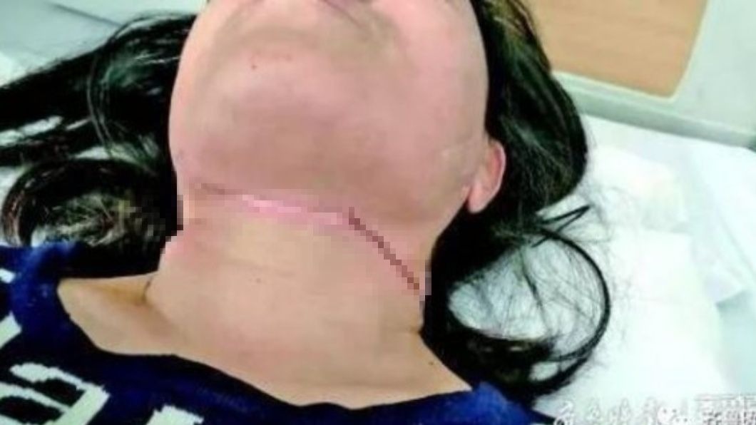 悚!女騎士被「風箏線割喉」慘摔倒地 當場噴血險斷頭