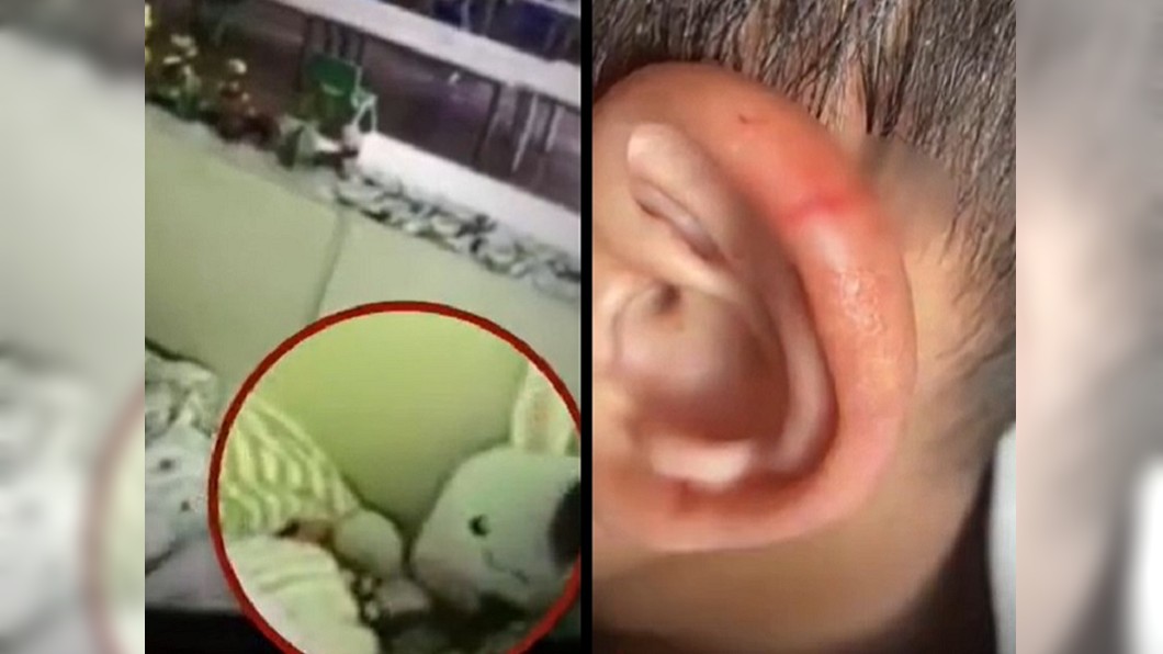 男童不午睡...被剪刀削耳　師辯：只是想嚇唬他