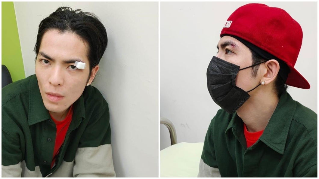 事後老蕭到醫院縫了6針。(圖/華納音樂提供)