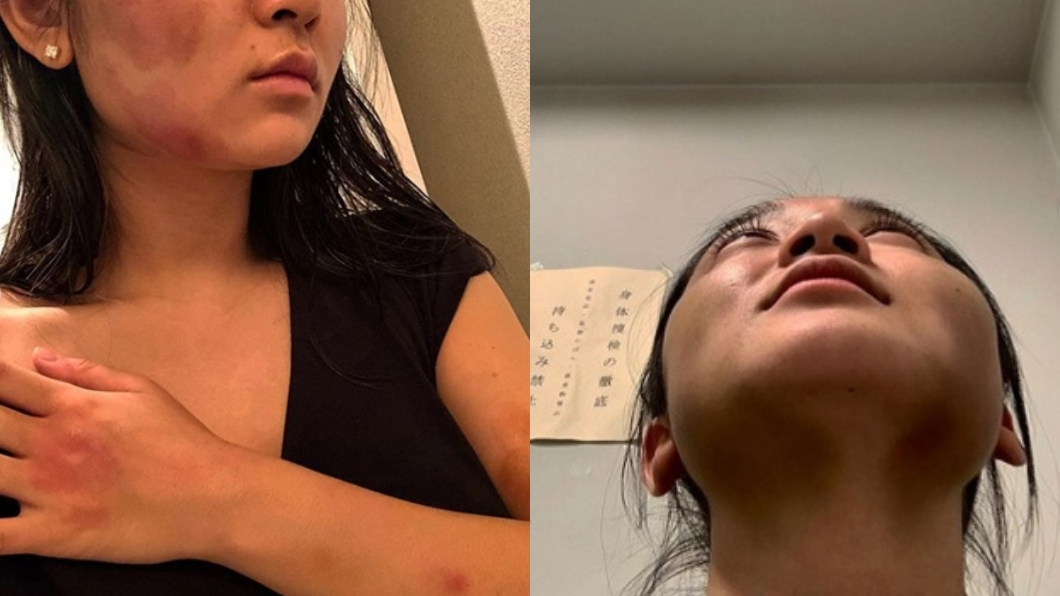 前日籍女友中浦悠花PO文控訴,蔣勁夫對她施暴的惡劣行徑。圖/翻攝自中浦悠花Instagram