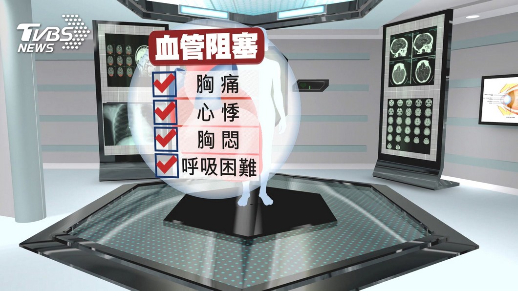 圖/TVBS