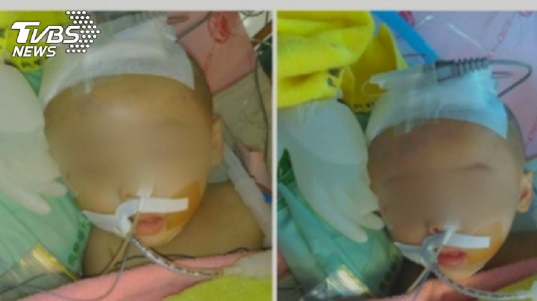 打翻珍奶忘記脫鞋 狠男把女友3歲兒打到頭顱破裂亡